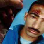 Torture stories of Kashmir reach Delhi University