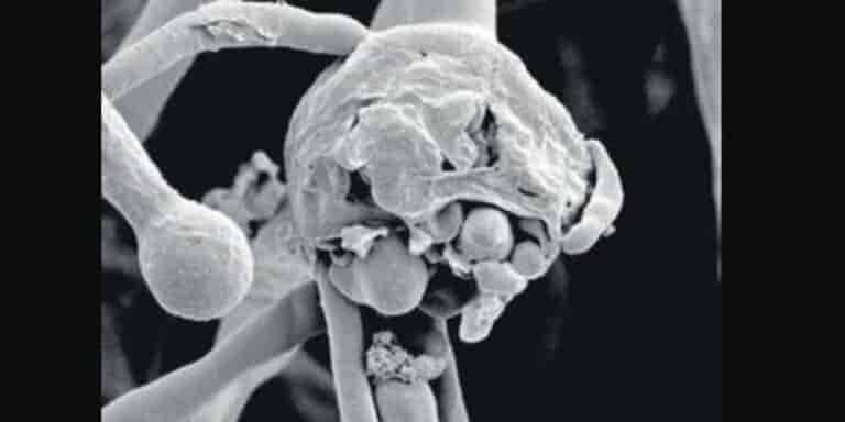 Man dies of black, white and yellow fungus in UP